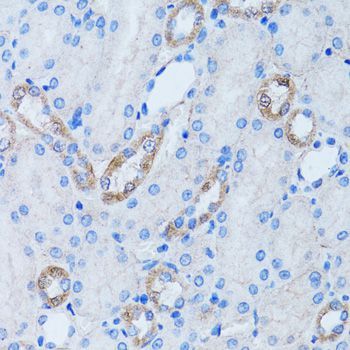 Immunohistochemistry - LDLRAP1 Polyclonal Antibody (144-07093)