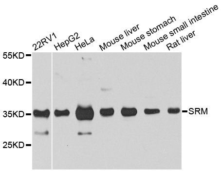 Western blot - SRM antibody (144-08151)