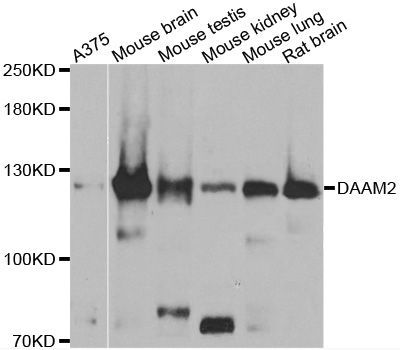 Western blot - DAAM2 antibody (144-07463)
