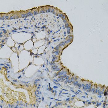Immunohistochemistry - RPLP0 Antibody (144-013633)