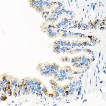Immunohistochemistry - RGS5 antibody (144-07015)