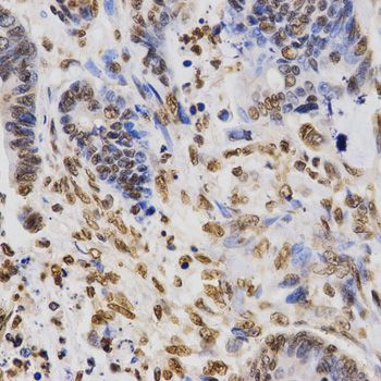 Immunohistochemistry - TriMethyl-Histone H3-K36 pAb (144-02366)