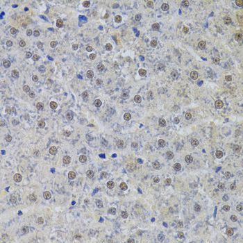 Immunohistochemistry - SNRPA Antibody (144-06410)