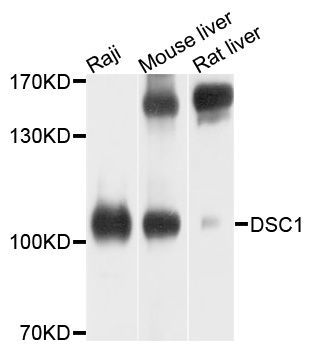 Western blot - DSC1 Polyclonal Antibody (144-10061)