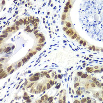 Immunohistochemistry - RNF2 Polyclonal Antibody (144-05563)