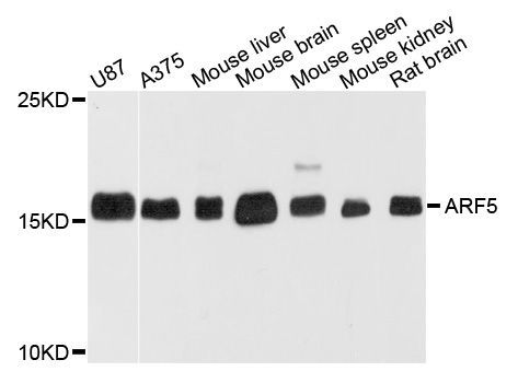 Western blot - ARF5 Polyclonal Antibody (144-03737)