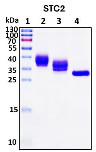 SDS-PAGE Image
