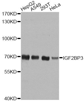 Western blot - IGF2BP3 Polyclonal Antibody (144-04444)