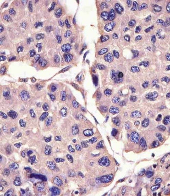 IHC-P