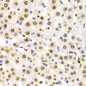 Immunohistochemistry - TriMethyl-Histone H3-K9 antibody (144-02360)