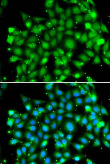 Immunofluorescence - SUFU antibody (144-013429)