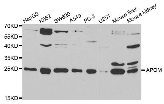 Western blot - APOM antibody (144-05336)