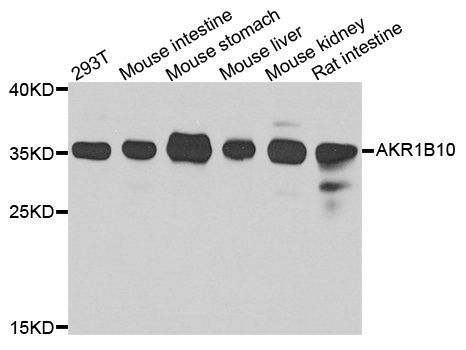 Western blot - AKR1B10 antibody (144-07823)