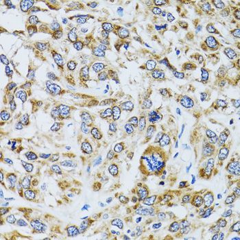 Immunohistochemistry - RPN1 antibody (144-600827)