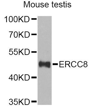 Western blot - ERCC8 Antibody (144-06884)