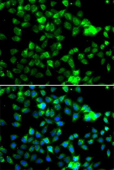 Immunofluorescence - NAA20 Polyclonal Antibody (144-07105)