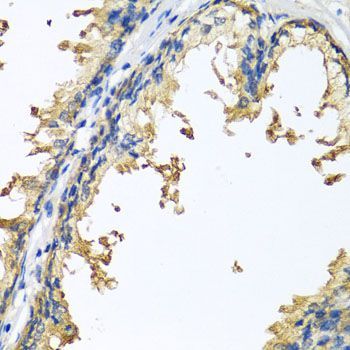 Immunohistochemistry - NLGN4Y antibody (144-04513)