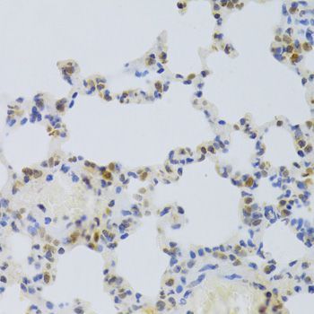 Immunohistochemistry - HMGB1 Polyclonal Antibody (144-02553)