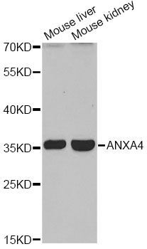 Western blot - ANXA4 antibody (144-603446)