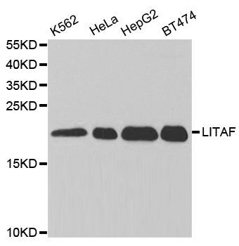 Western blot - LITAF Polyclonal Antibody (144-05469)