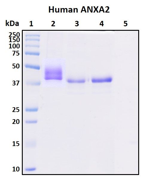 SDS-PAGE