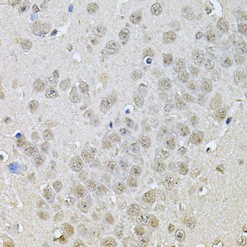Immunohistochemistry - DR1 Polyclonal Antibody (144-06903)