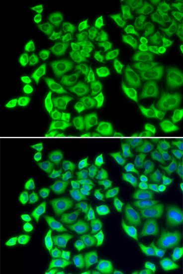 Immunofluorescence - EEF1D antibody (144-02509)