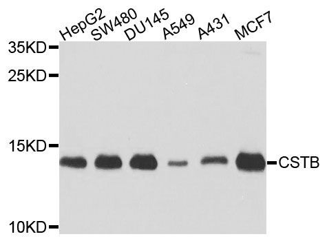 Western blot - CSTB Polyclonal Antibody (144-03815)