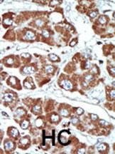 IHC-P