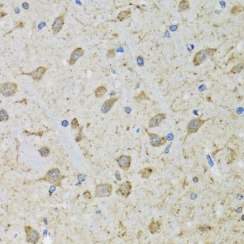 Immunohistochemistry - DHRS2 antibody (144-06446)