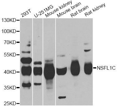 Western blot - NSFL1C Polyclonal Antibody (144-06677)