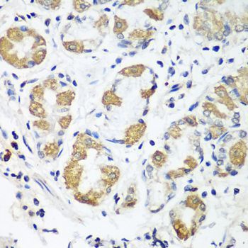 Immunohistochemistry - [KO Validated] OXCT1 Polyclonal Antibody (144-08139)