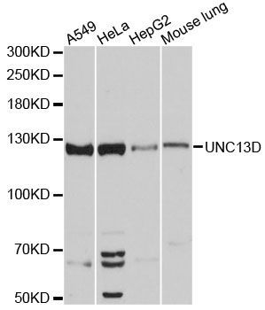 Western blot - UNC13D antibody (144-60210)