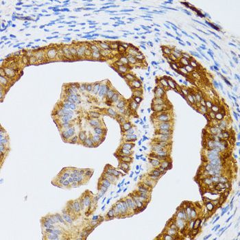 Immunohistochemistry - CHAF1B antibody (144-06259)