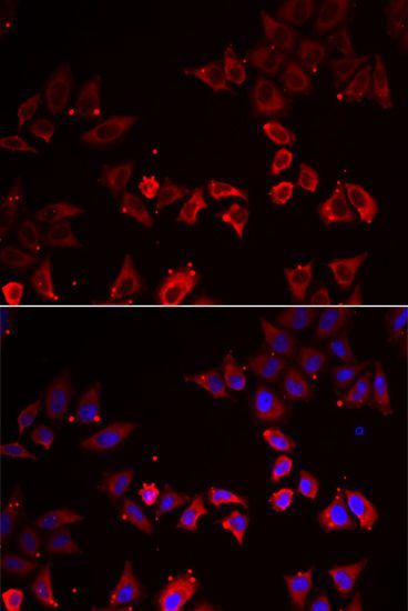 Immunofluorescence - LIMS1 antibody (144-013917)