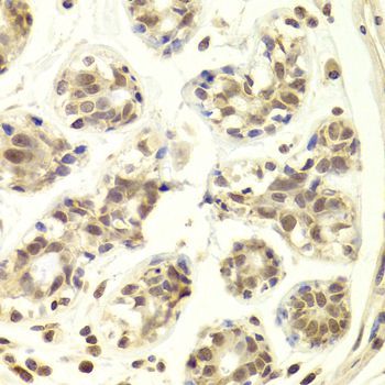 Immunohistochemistry - PRPF3 Polyclonal Antibody (144-05482)