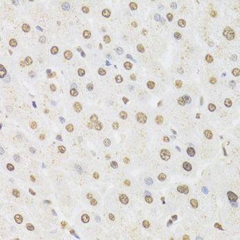Immunohistochemistry - HNRNPD Polyclonal Antibody (144-01828)