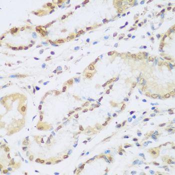 Immunohistochemistry - CCND2 antibody (144-01773)