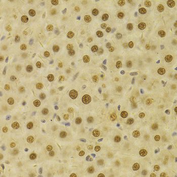 Immunohistochemistry - HDGF Antibody (144-05347)