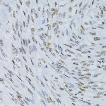 Immunohistochemistry - SNRNP70 antibody (144-06065)