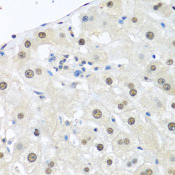 Immunohistochemistry - UBC antibody (144-03207)