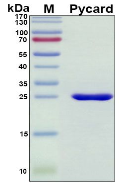 SDS-PAGE