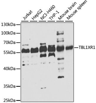 Western blot - TBL1XR1 antibody (144-07834)