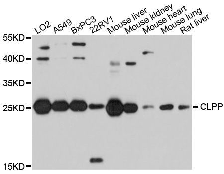 Western blot - CLPP antibody (144-09127)