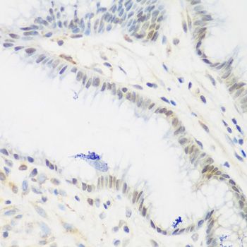 Immunohistochemistry - IGF2BP3 Polyclonal Antibody (144-04444)