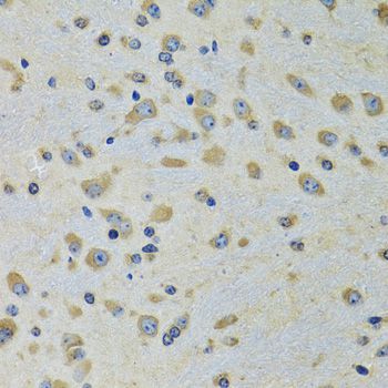 Western blot - DARS Polyclonal Antibody (144-06574)