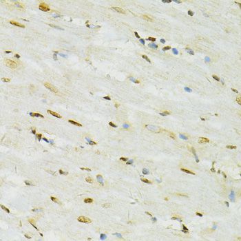 Immunohistochemistry - ADAR Polyclonal Antibody (144-07869)