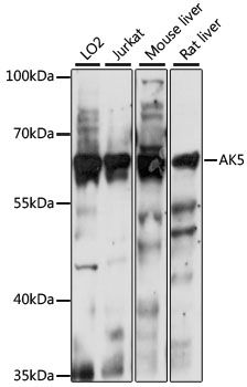 Western blot - AK5 antibody (144-61048)