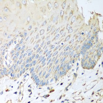 Immunohistochemistry - SGCB antibody (144-06979)
