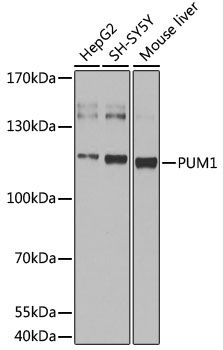Western blot - pum1 antibody (144-013389)